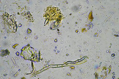 Kompost mikroorganizmaları mikroskop altında amip, kırbaç, nematodlar, mantarlar, bakteriler