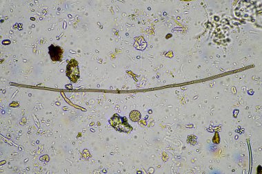 Biyoloji mikroskop altında amip, kırbaç, nematod, mantar, bakteri
