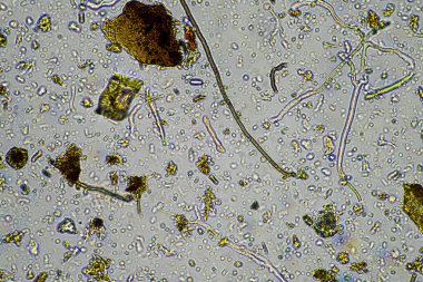 microorganisms and soil biology, with nematodes and fungi under the microscope. in a soil and compost sample clipart