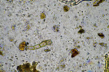 Mikroskopi altında toprak, kum, çamur ve toprak biyolojisi, amip, mantar, mikrop ve bir sığır çiftliğindeki nematodlara bakıyor.