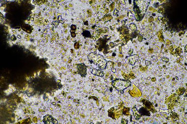 Kompost mikroorganizmaları mikroskop altında amip, kırbaç, nematodlar, mantarlar, bakteriler