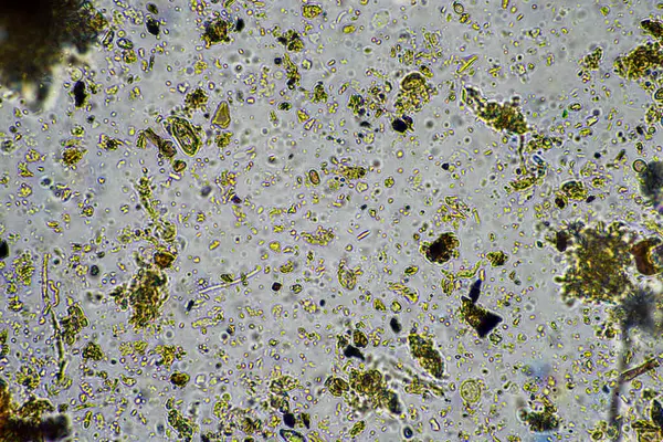 stock image Soil under the microscopy, looking at sand, silt and clay and soil biology, amoebae, fungi, fungal, microbes and nematodes in a cattle farm