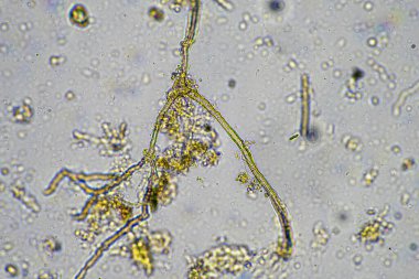Bir laboratuarda amip, kırbaç, nematod, mantar, bakteri, virüs ve hayvan ve insan sağlığı hastalıklarını içeren mikroskop altında bulunan mikroorganizmalar