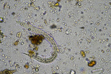 Mikroskopi altında toprak, kum, çamur ve toprak biyolojisi, amip, mantar, mikrop ve bir sığır çiftliğindeki nematodlara bakıyor.