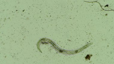 mikroorganizmalar ve toprak biyolojisi, mikroskop altında nematodlar ve mantarlar. Toprakta ve gübre örneğinde