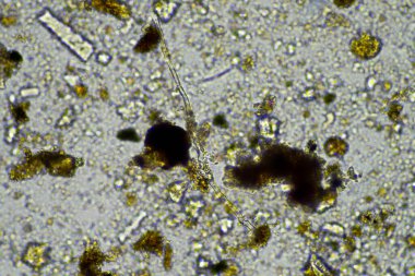 Mikroskobik görünümün mikroskobu