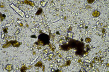 Işıktaki mikroskobik hücrelerin mikroskobu