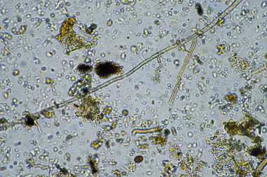 microorganisms and soil biology, with nematodes and fungi under the microscope. in a soil and compost sample in australia clipart