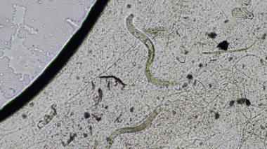 mikroorganizmalar ve toprak biyolojisi, mikroskop altında nematodlar ve mantarlar. Toprakta ve gübre örneğinde