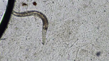 mikroorganizmalar ve toprak biyolojisi, mikroskop altında nematodlar ve mantarlar. Toprakta ve gübre örneğinde