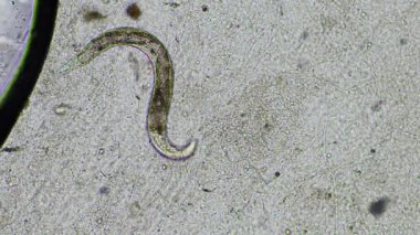 mikroorganizmalar ve toprak biyolojisi, mikroskop altında nematodlar ve mantarlar. Toprakta ve gübre örneğinde