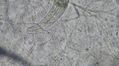 mikroorganizmalar ve toprak biyolojisi, mikroskop altında nematodlar ve mantarlar. Toprakta ve gübre örneğinde