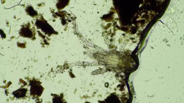 mikroskop altında toprak mikropları. gübre içinde mantarlı mikroorganizmalar