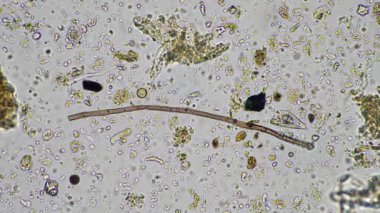 mikroskop altında toprak mikropları. gübre içinde mantarlı mikroorganizmalar