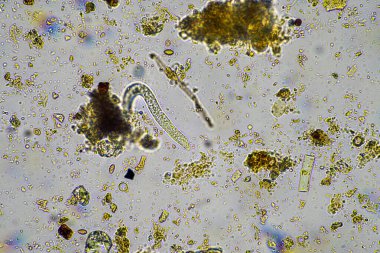 soil microbes under the microscope. microorganisms with fungus in compost clipart