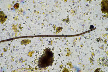 soil microbes under the microscope. microorganisms with fungus in compost clipart