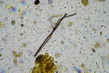 mikroskop altında toprak mikropları. gübre içinde mantarlı mikroorganizmalar