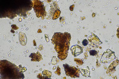 Avusturalya 'da mikroskop altında nematodları ve mantarları olan mikroorganizmalar ve toprak biyolojisi.