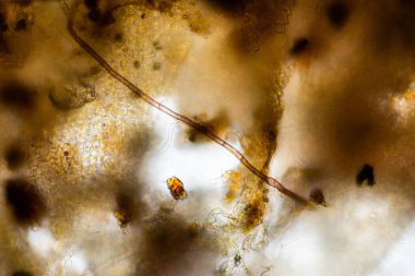 Topraktaki toprak ve gübre örnekleri, mantar ve mantarlar ve rejeneratif tarımda mikroskop altında bulunan toprak mikropları. Avusturalya 'da.