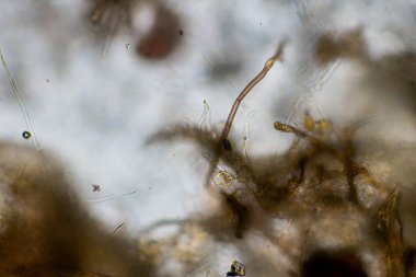 mikroorganizmalar ve toprak biyolojisi, mikroskop altında nematodlar ve mantarlar. Toprakta ve gübre örneğinde