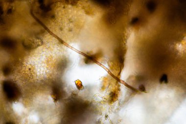 mikroorganizmalar ve toprak biyolojisi, mikroskop altında nematodlar ve mantarlar. Toprakta ve gübre örneğinde