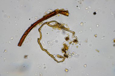 Topraktaki toprak ve gübre örnekleri, mantar ve mantarlar ve rejeneratif tarımda mikroskop altında bulunan toprak mikropları. Avusturalya 'da.