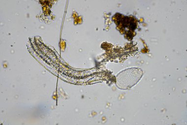 mikroorganizmalar ve toprak biyolojisi, mikroskop altında nematodlar ve mantarlar. Toprakta ve gübre örneğinde