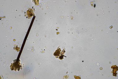 mikroorganizmalar ve toprak biyolojisi, mikroskop altında nematodlar ve mantarlar. Toprakta ve gübre örneğinde