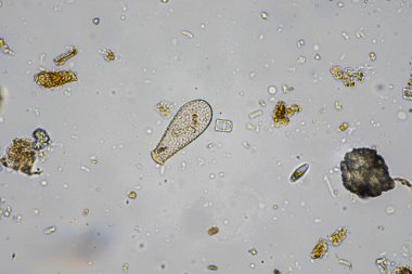 mikroorganizmalar ve toprak biyolojisi, mikroskop altında nematodlar ve mantarlar. Toprakta ve gübre örneğinde