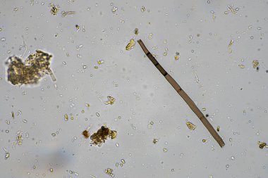 Topraktaki toprak ve gübre örnekleri, mantar ve mantarlar ve rejeneratif tarımda mikroskop altında bulunan toprak mikropları. Avusturalya 'da.