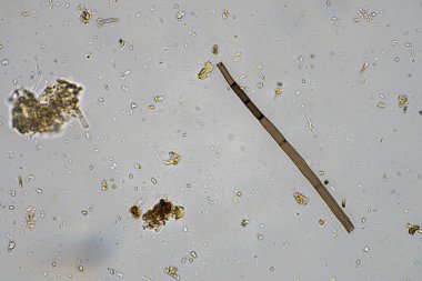 mikroorganizmalar ve toprak biyolojisi, mikroskop altında nematodlar ve mantarlar. Toprakta ve gübre örneğinde