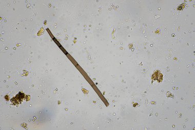 mikroorganizmalar ve toprak biyolojisi, mikroskop altında nematodlar ve mantarlar. Toprakta ve gübre örneğinde