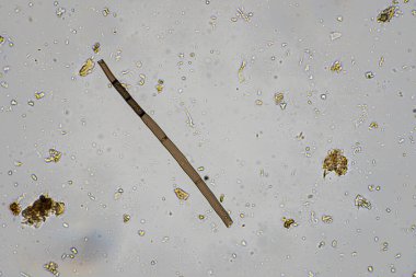 Topraktaki toprak ve gübre örnekleri, mantar ve mantarlar ve rejeneratif tarımda mikroskop altında bulunan toprak mikropları. Avusturalya 'da.