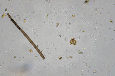 mikroorganizmalar ve toprak biyolojisi, mikroskop altında nematodlar ve mantarlar. Toprakta ve gübre örneğinde