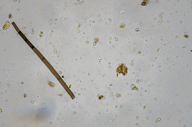 Topraktaki toprak ve gübre örnekleri, mantar ve mantarlar ve rejeneratif tarımda mikroskop altında bulunan toprak mikropları. Avusturalya 'da.