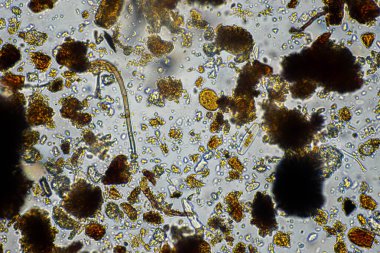 mikroorganizmalar ve toprak biyolojisi, mikroskop altında nematodlar ve mantarlar. Toprakta ve gübre örneğinde