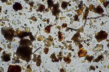 Topraktaki toprak ve gübre örnekleri, mantar ve mantarlar ve rejeneratif tarımda mikroskop altında bulunan toprak mikropları. Avusturalya 'da.