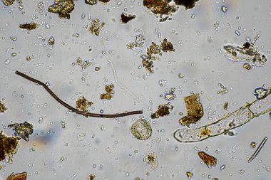 mikroorganizmalar ve toprak biyolojisi, mikroskop altında nematodlar ve mantarlar. Toprakta ve gübre örneğinde