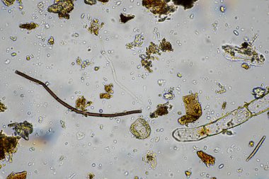 Topraktaki toprak ve gübre örnekleri, mantar ve mantarlar ve rejeneratif tarımda mikroskop altında bulunan toprak mikropları. Avusturalya 'da.