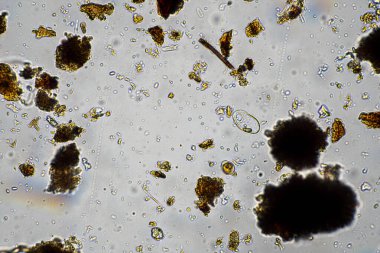 Topraktaki toprak ve gübre örnekleri, mantar ve mantarlar ve rejeneratif tarımda mikroskop altında bulunan toprak mikropları. Avusturalya 'da.