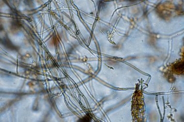 mikroorganizmalar ve toprak biyolojisi, mikroskop altında nematodlar ve mantarlar. Toprakta ve gübre örneğinde