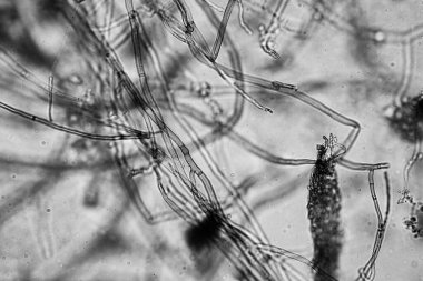 Topraktaki toprak ve gübre örnekleri, mantar ve mantarlar ve rejeneratif tarımda mikroskop altında bulunan toprak mikropları. Avusturalya 'da.