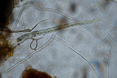 Topraktaki toprak ve gübre örnekleri, mantar ve mantarlar ve rejeneratif tarımda mikroskop altında bulunan toprak mikropları. Avusturalya 'da.