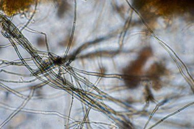 mikroorganizmalar ve toprak biyolojisi, mikroskop altında nematodlar ve mantarlar. Toprakta ve gübre örneğinde