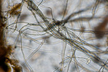 mikroorganizmalar ve toprak biyolojisi, mikroskop altında nematodlar ve mantarlar. Toprakta ve gübre örneğinde