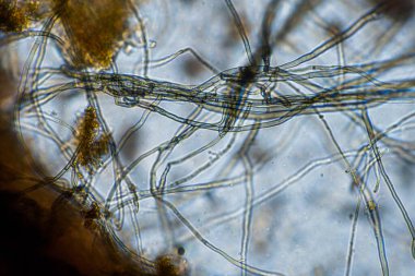 Topraktaki toprak ve gübre örnekleri, mantar ve mantarlar ve rejeneratif tarımda mikroskop altında bulunan toprak mikropları. Avusturalya 'da.