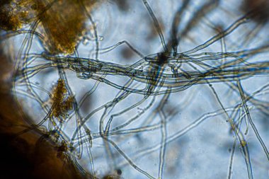 Topraktaki toprak ve gübre örnekleri, mantar ve mantarlar ve rejeneratif tarımda mikroskop altında bulunan toprak mikropları. Avusturalya 'da.