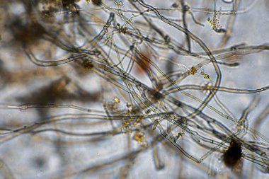 mikroorganizmalar ve toprak biyolojisi, mikroskop altında nematodlar ve mantarlar. Toprakta ve gübre örneğinde