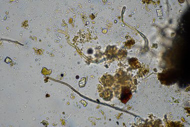 mikroorganizmalar ve toprak biyolojisi, mikroskop altında nematodlar ve mantarlar. Toprakta ve gübre örneğinde