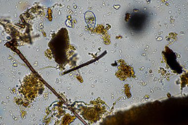 mikroorganizmalar ve toprak biyolojisi, mikroskop altında nematodlar ve mantarlar. Toprakta ve gübre örneğinde